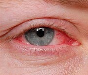 بیماری‌هایی که از راه چشم تشخیص داده می‌شوند