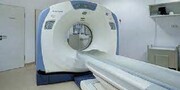۴ دستگاه سی‌تی اسکن پیشرفته برای بیمارستان‌های خراسان جنوبی تأمین شد