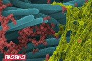 ببینید | تصاویر سلول‌های آلوده به "کروناویروس سندرم حاد تنفسی ۲"
