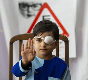 غربالگری بینایی بیش از ۱۸هزار کودک در قزوین 