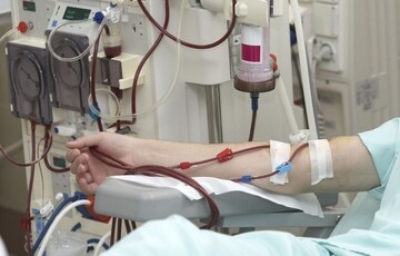تخصیص ۳۸ دستگاه دیالیز برای بیمارستان‌های همدان

