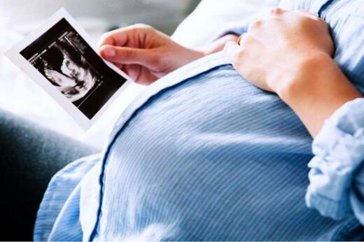 زارع: پیشنهاد حذف غربالگری زنان باردار را به حساب مجلس نگذارید
