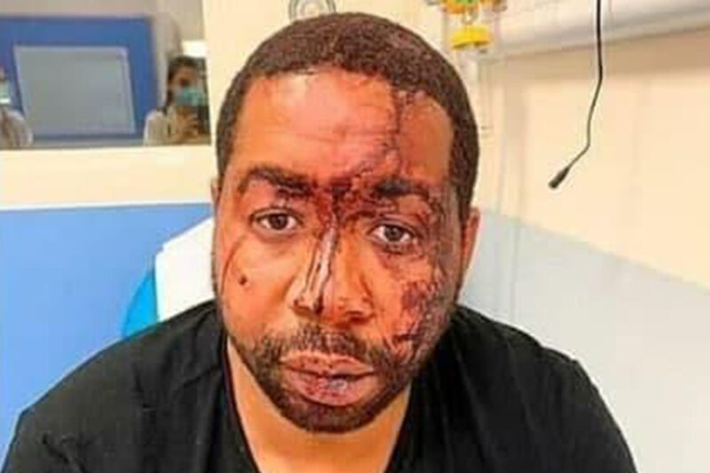 ببینید | لحظه حمله وحشیانه و نژادپرستانه پلیس فرانسه به یک هنرمند رنگین‌پوست