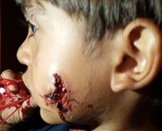 ️رودخانه شور مقصر حمله سگها به کودکان شد! /کودکی که سگها صورتش را دریدند