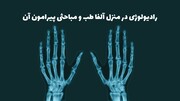 رادیولوژی در منزل آلفا طب و مباحثی پیرامون آن