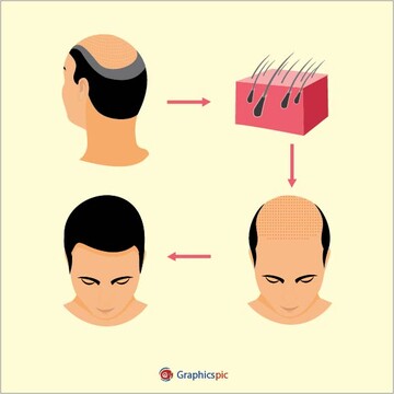 کاشت مو و ترمیم مو چه تفاوت‌هایی دارند؟