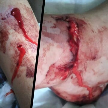 تکرار حادثه تلخ حمله سگ‌های بلاصاحب به یک کودک درفاز۲ پرند/چرا شهرداری پرند در جمع آوری سگها قاطعیت به خرج نمی دهد؟
