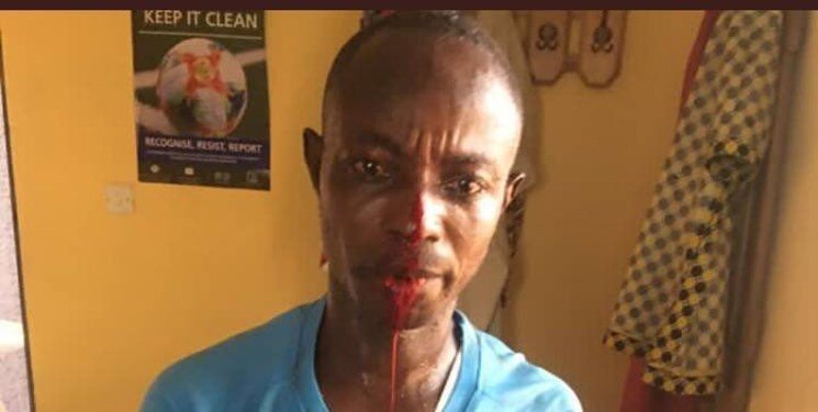 ضرب و شتم خونین داوران در غنا/عکس