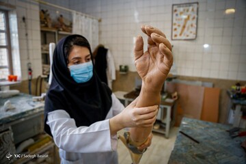 مرکز ساخت پروتز و ارتز