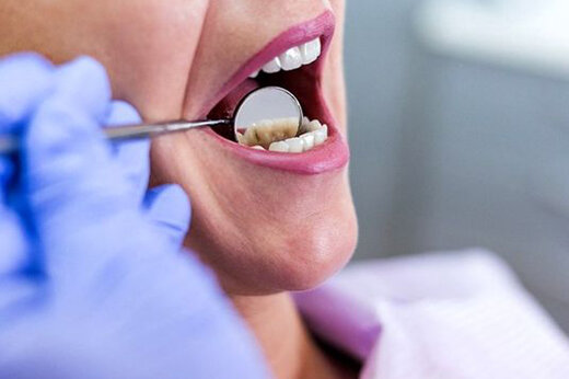 چگونه زخم‌های دهان را درمان کنیم؟