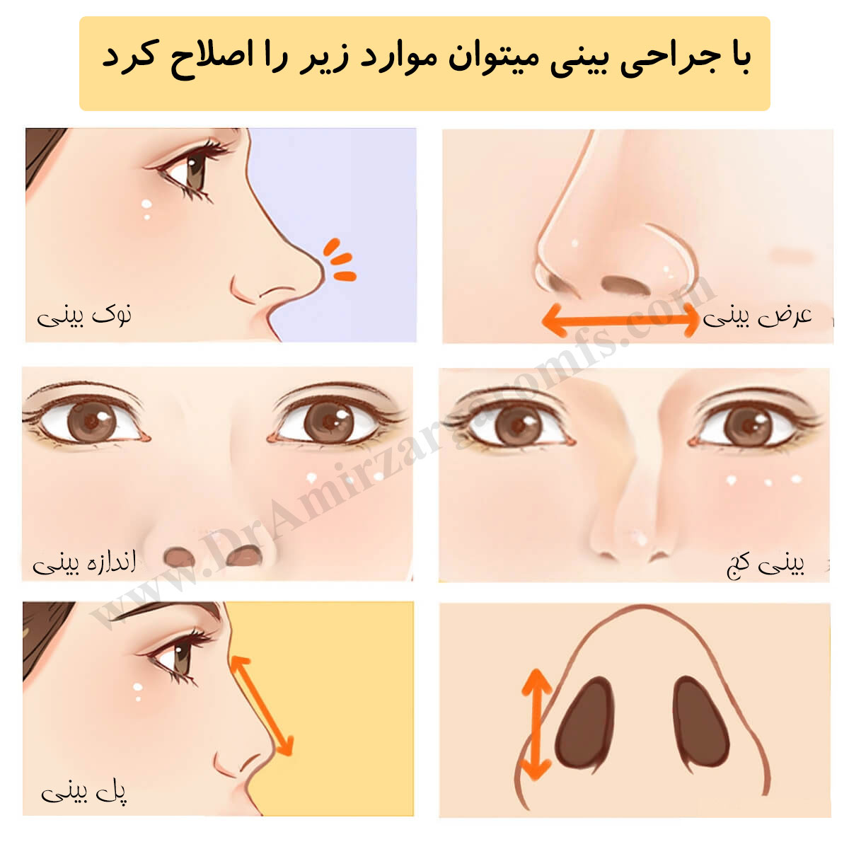 آشنایی با ساختار بینی و جراحی بینی