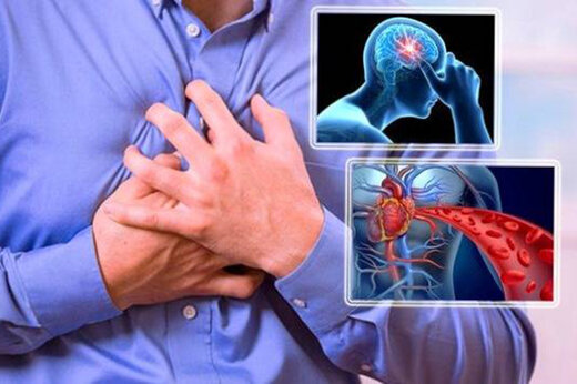 ببینید | دلایل گرفتگی عروق، پیشگیری و درمان