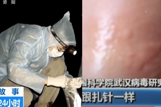 ببینید | اثبات گاز گرفته شدن دست دانشمندان چینی توسط خفاش