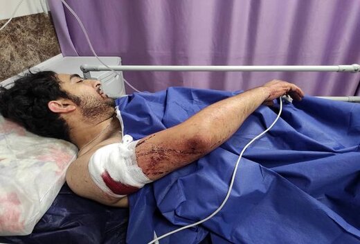 شوکِ ناشی از ۲۱ ضربه چاقو که بر بدن محمد دلکش، عکاس ایرانی وارد آمد