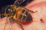 ببینید | روش عجیب درمان بیماری‌ها با نیش زنبور