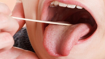 چرا دچار خشکی دهان می‌شویم؟
