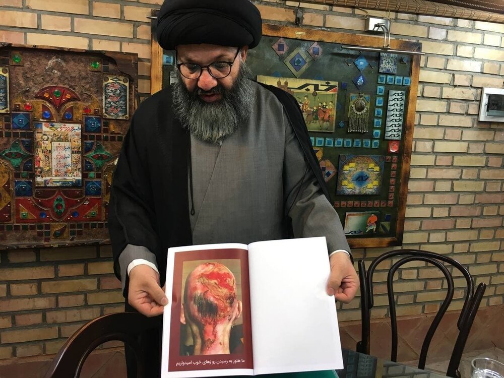 ماجرای پانسمان‌های خارجی که در ایران گم شد/ ٢٧ ماه است منتظر جواب وزیر بهداشتیم
