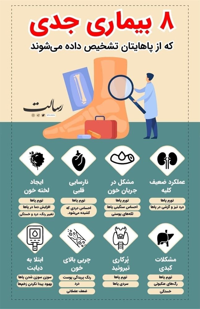 اینفوگرافیک | هشت بیماری جدی که از طریق پا تشخیص داده می‌شوند