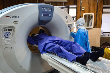 ببینید | اگر این علائم را دارید باید سی‌تی‌اسکن بگیرید