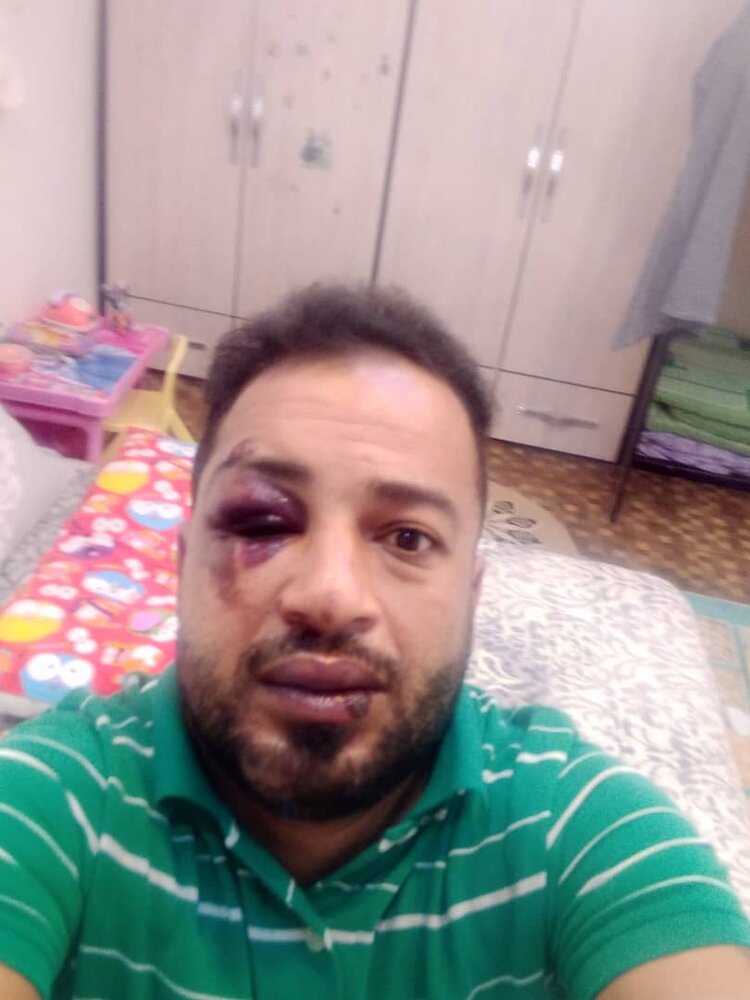 افتادن خانواده سه نفره آبادانی در چاله ای آنان را راهی بیمارستان کرد