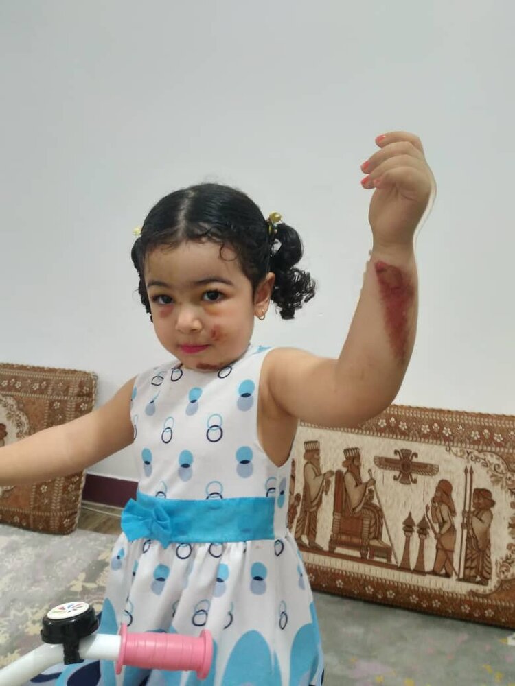 افتادن خانواده سه نفره آبادانی در چاله ای آنان را راهی بیمارستان کرد