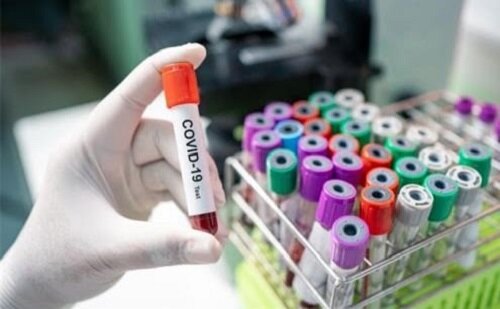 متخصص میکروب شناسی از احتمال تست کاذب منفی در سویه دلتا خبر داد