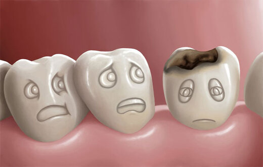 چهار دشمنی که سلامت دندان‌هایتان را تهدید می‌کنند 