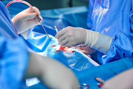 عمل جراحی موفق برای خارج کردن سیخ از گیجگاه یک جوان/ تصویر