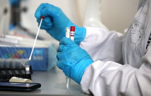 اعلام جدیدترین فهرست آزمایشگاه‌های مجاز تشخیص کووید۱۹ در کشور