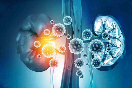 بشنوید | هشدار درباره تاثیر کووید ۱۹ بر عملکرد کلیه و مجاری ادراری