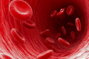 ۱۹ راهکار طبیعی برای درمان کم خونی
