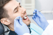 میزان دوام دندان ها بعد از عصب کشی چقدر است؟