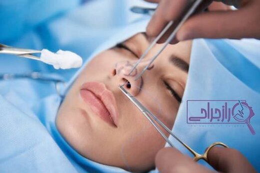 تعرفه عمل بینی گوشتی ، استخوانی و ترمیمی