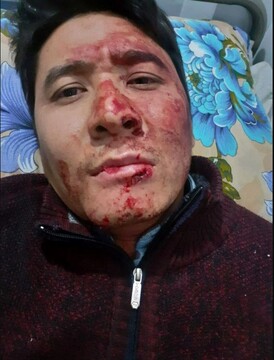 خبرنگار صداوسیما هدف ۷ گلوله قرار گرفت!