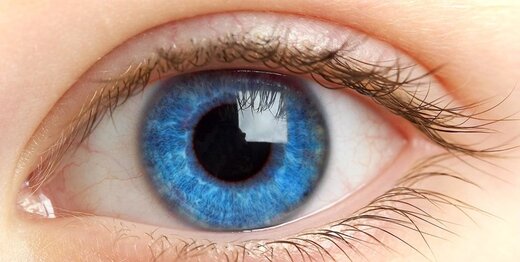 خطرات استفاده از لنز زیبایی چشمی که در سوپرمارکت‌ها می‌فروشند