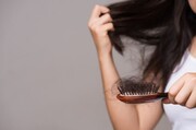 پنج علت ریزش مو در زنان
