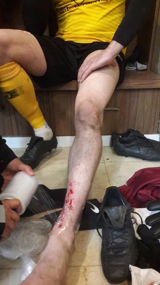 بازیکن پرسپولیس حقیقی را بدجور زخمی کرد!/عکس