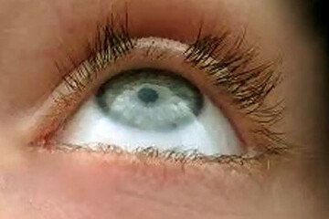 اینفوگرافیک | چند علت درباره آسیب‌پذیر شدن مژه‌ها