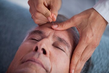 طب سوزنی درمانی اثربخش و بدون درد برای انواع بیماری‌ها