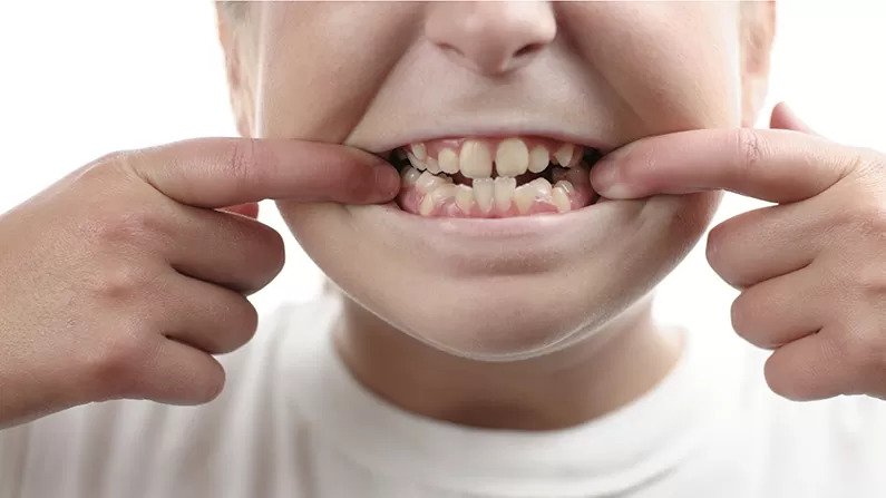 کدام دندان­پزشک ارتودنسی را بهتر انجام می دهد؟