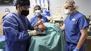پیوند ناموفق قلب خوک به انسان، پس از دو ماه منجر به مرگ بیمار شد / عکس