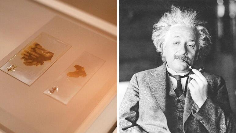 ماجرای عجیب دزدی مغز اینشتین توسط یک پزشک/ عکس