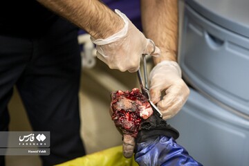 مصدومان چهارشنبه سوزی!