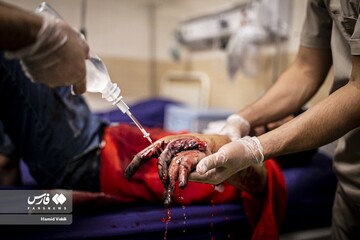 مصدومان چهارشنبه سوزی!