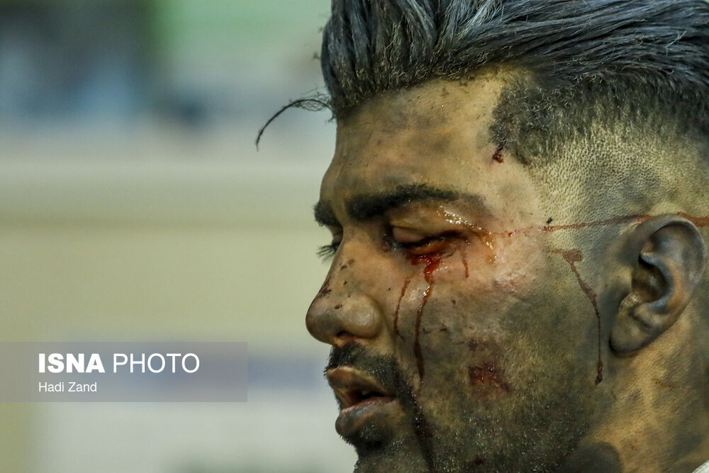 تصاویر تکان دهنده از مصدومان چهارشنبه‌سوری امسال؛ بیشترین مرگ در ده سال گذشته رقم خورد