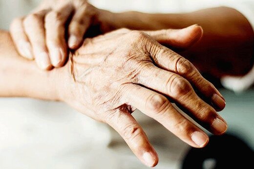 تفاوتهای جالب پارکینسون و اماس