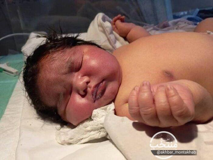 5686038 - این نوزاد مشهدی سنگین وزن ترین نوزاد متولد شده جهان است؟/ عکس