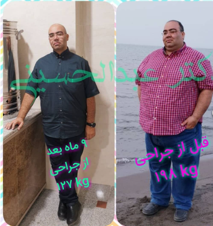 با ورژن قدیمی خود خداحافظی کنید