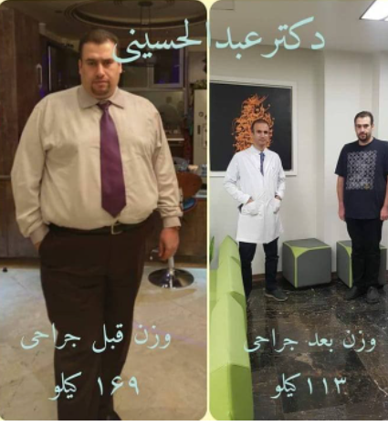 قبل و بعد از جراحی لاغری