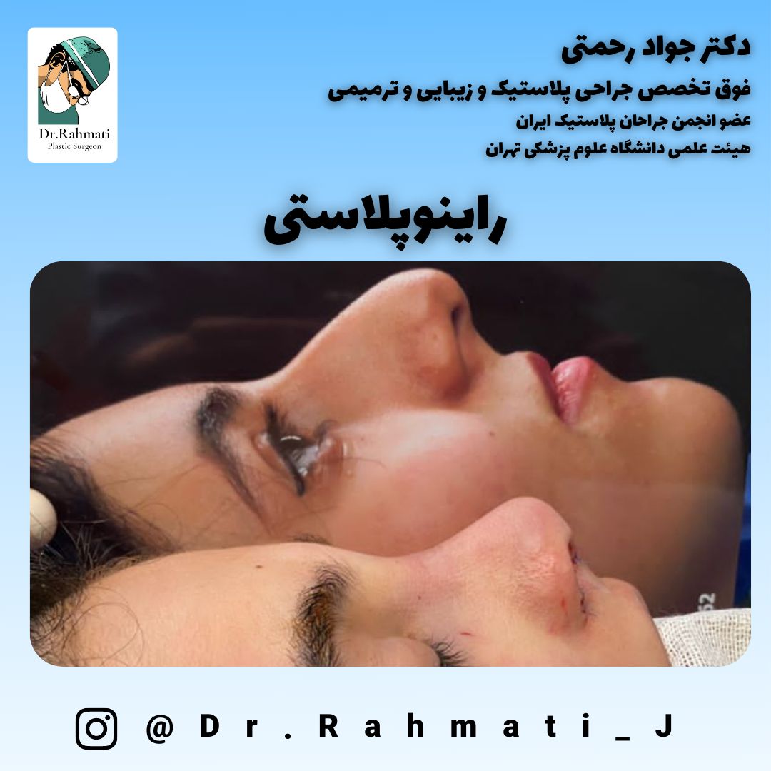 از دو تکنیک باز و بسته برای جراحی بینی استفاده میشود